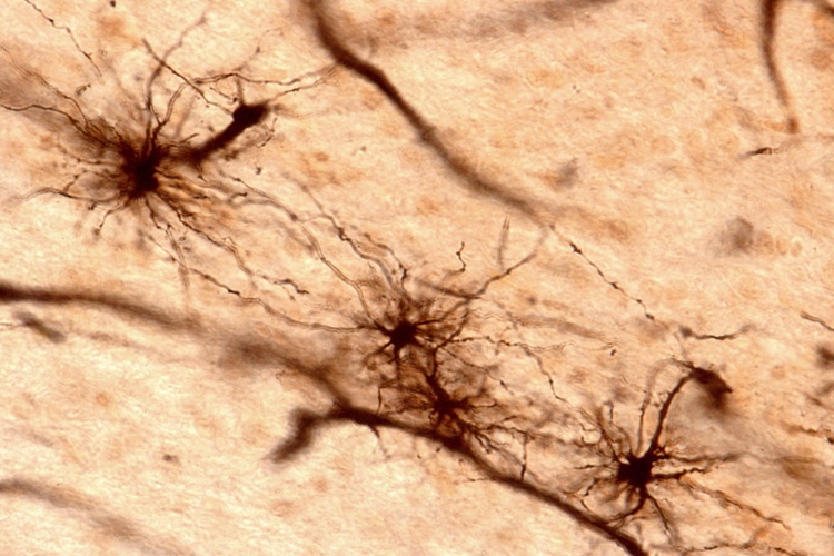 Multiple astrocytes in the central nervous system displaying their highly branched morphology