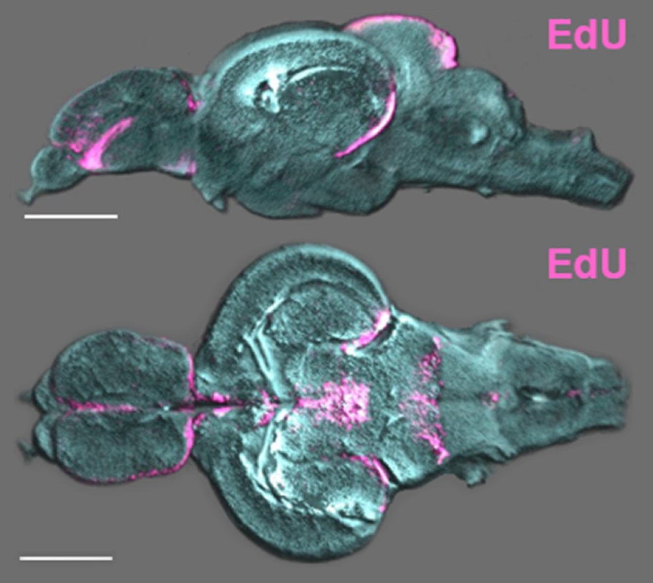 A Whole Brain Staining, Embedding, and Clearing Pipeline for Adult Zebrafish to Visualize Cell Proliferation and Morphology in 3-Dimensions