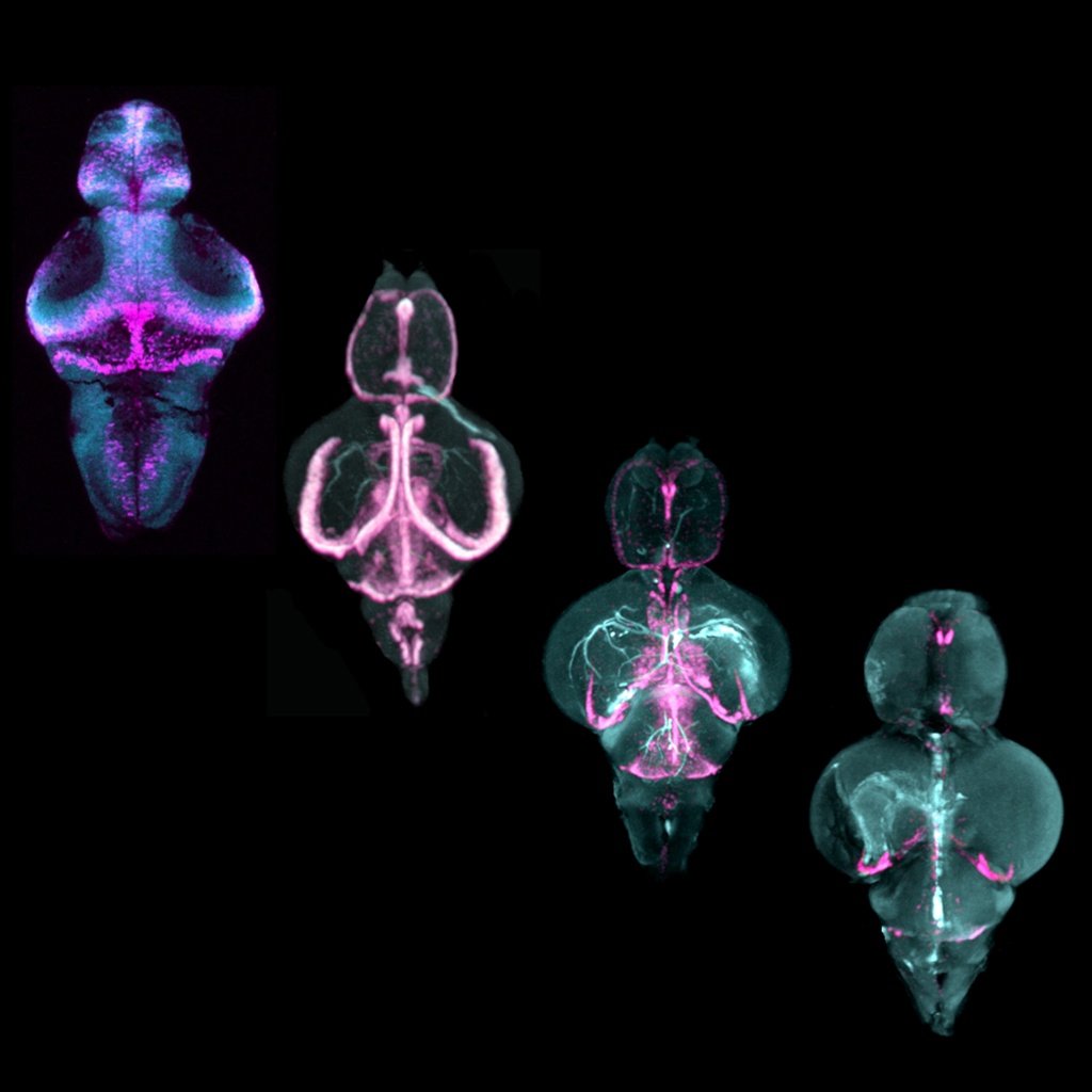 Images of optically cleared zebrafish brains from larval to senescent stages of development showing zones of cell proliferation in pink