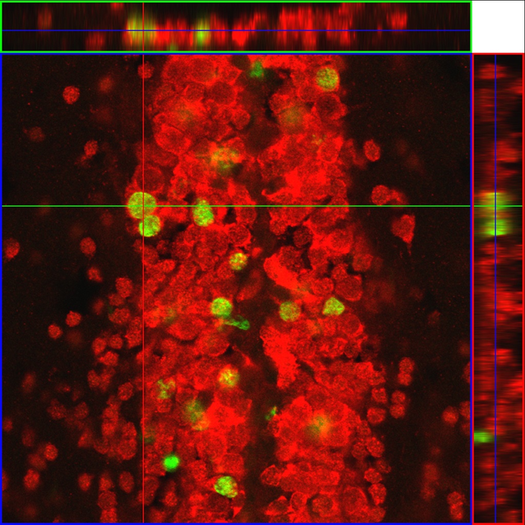 Double-labelling for BrdU (green) and the neuronal marker HuC/D (red) showing a newly born neuron in the mature forebrain of the zebrafish in cross-section