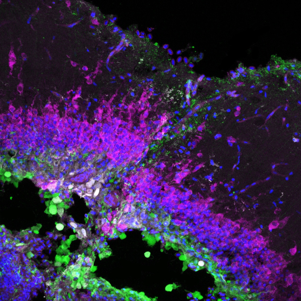 Stab injury to the adult zebrafish tectum displaying the disrupted quiescent radial-glial layer in green, neurons in pink, and DAPI counterstain in blue